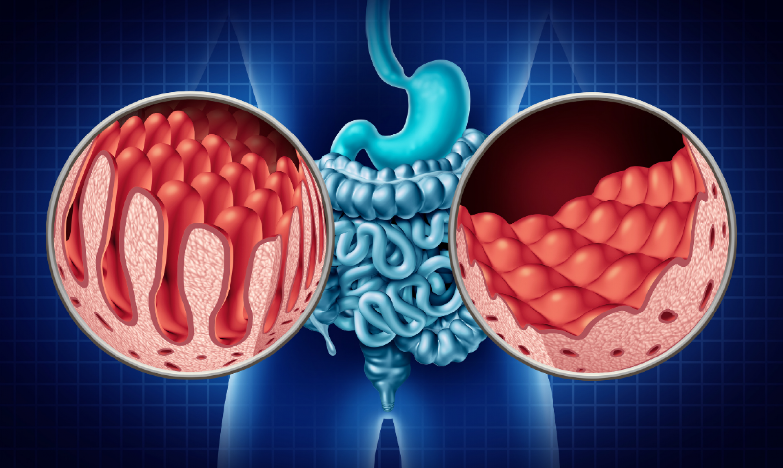 Envejecimiento intestinal
