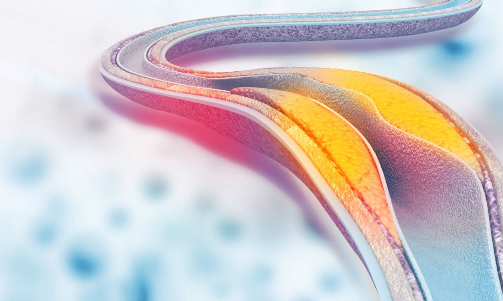 ¿Qué hacer si tengo colesterol alto?