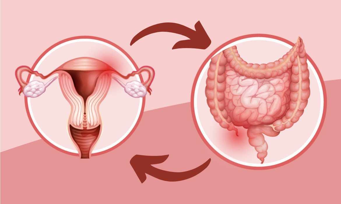 mplicación de la microbiota intestinal en la producción de estrógenos